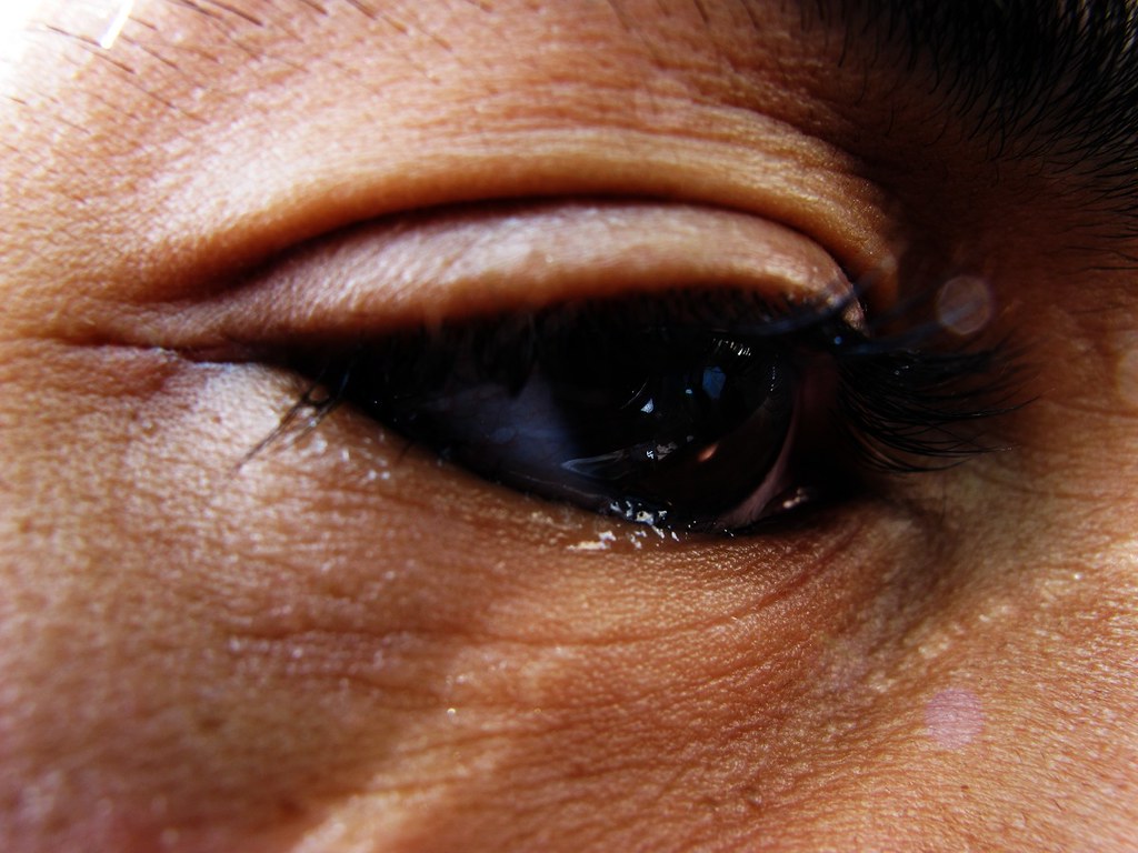 My watery eye