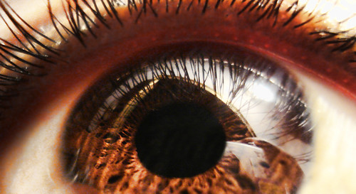 My Cornea looks like a Black hole!