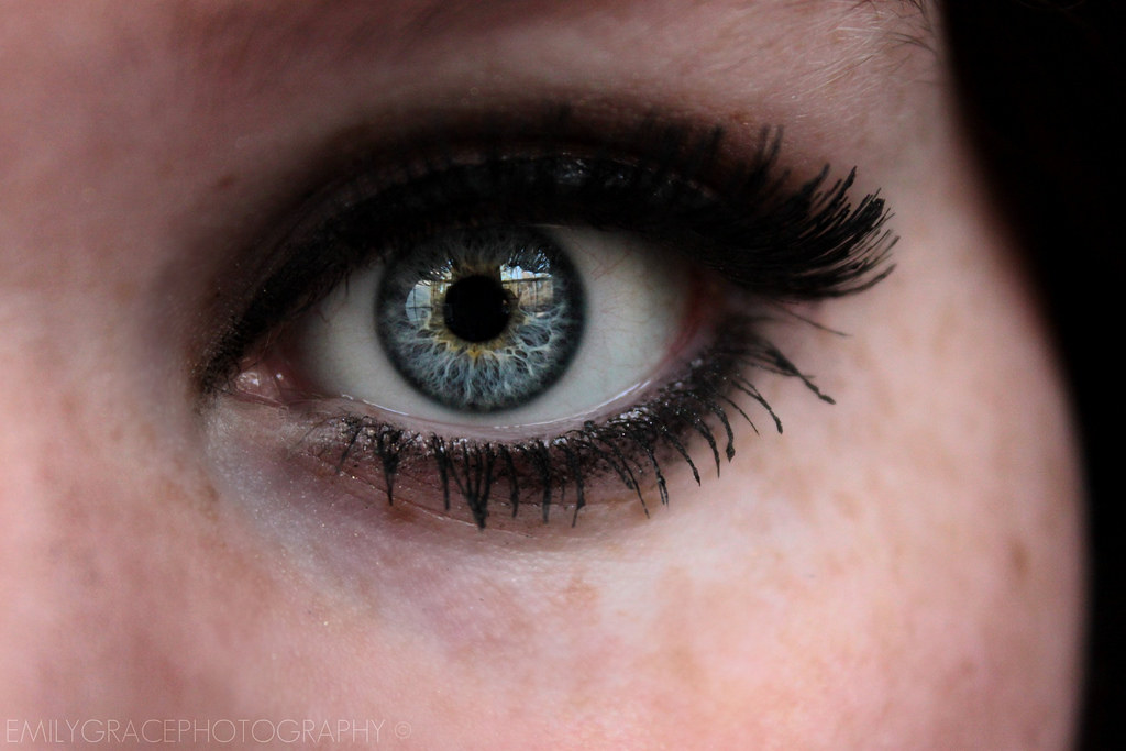 gold eyelid weight implant