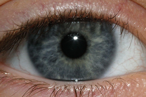 Blue Eye