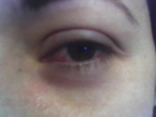 Yuck!