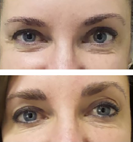 Microblading thickens eyebrows - before and after