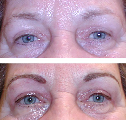 eyebrows and eyeliner with micropigmentation