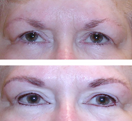 brow enhancement and permanent eyeliner