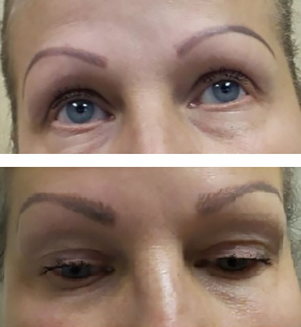 Microblading permanent eyebrows for a stylish and more natural shape