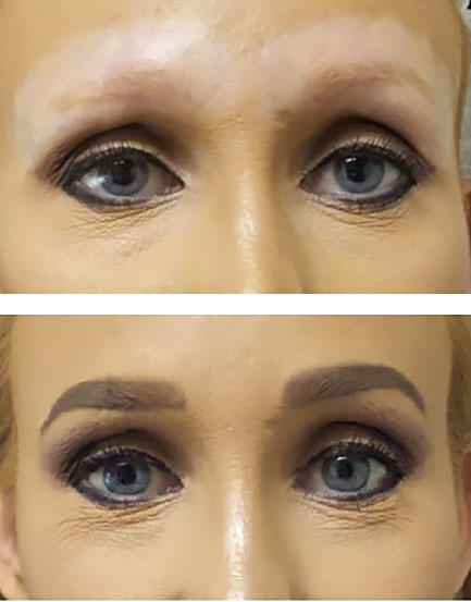 Flat and wide permanent eyebrows with microblading - before/after image